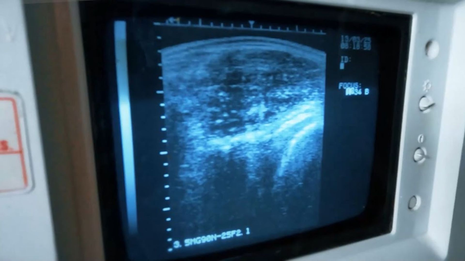 Ultrassonografia de carcaça impulsiona a pecuária e antecipa lucros desde a desmama